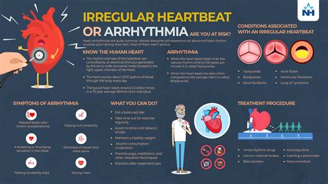 rapid or irregular beating of the heart figgerits|Rapid or irregular beating of the heart Figgerits Answer.